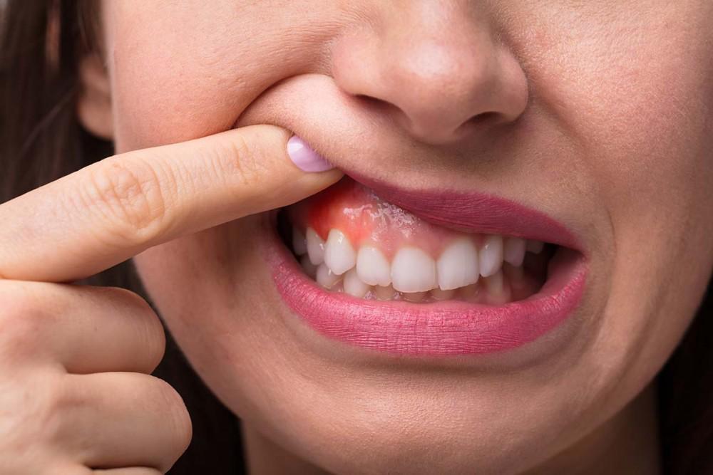 Periodontal Treatment